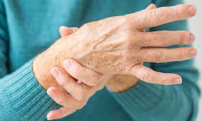 Physical therapy can help manage carpal tunnel syndrome and serves as a great alternative to surgery
