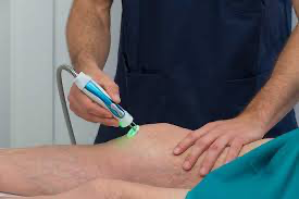 cold laser physical therapy treatment